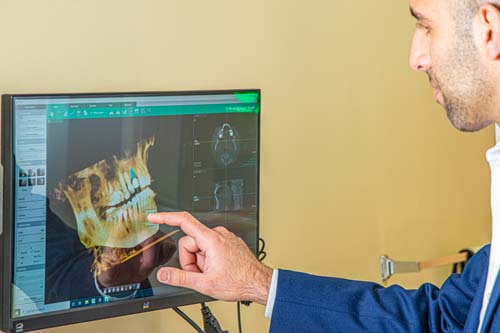 Dr Bral Planning Dental Implant Treatment on X-ray Software